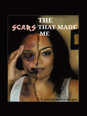 cover image of THE SCARS THAT MADE ME